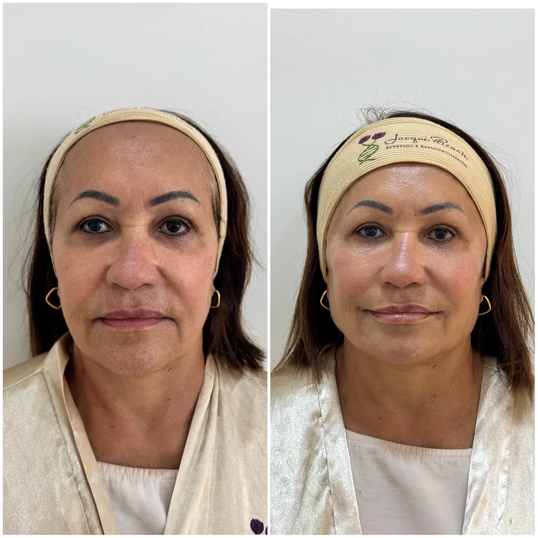 aedf153d-f974-45c9-8155-8c3fa71c61c7-12405-00000931fbd2bb99-1-685c0f525cdf9