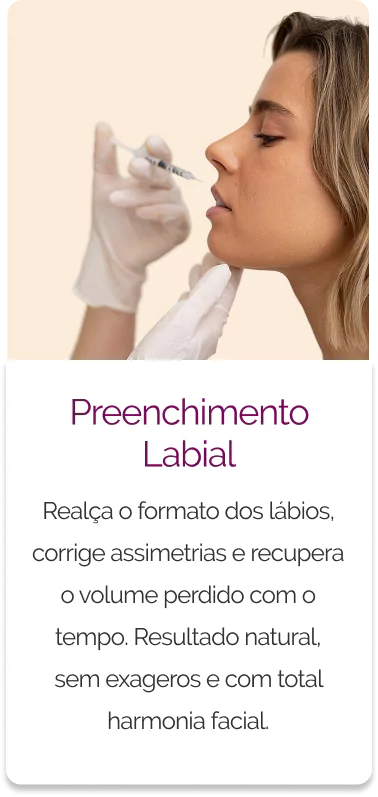 preenchimento-labial-685bea28ac25b
